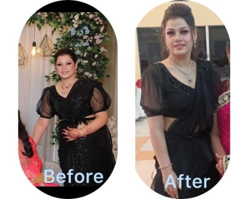 Sheetal Lekhi &mdash; before and after