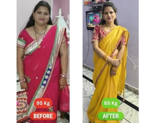 Deepika Agarwal &mdash; before and after