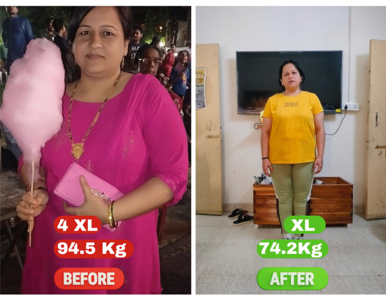 Arifa, 41 &mdash; before and after