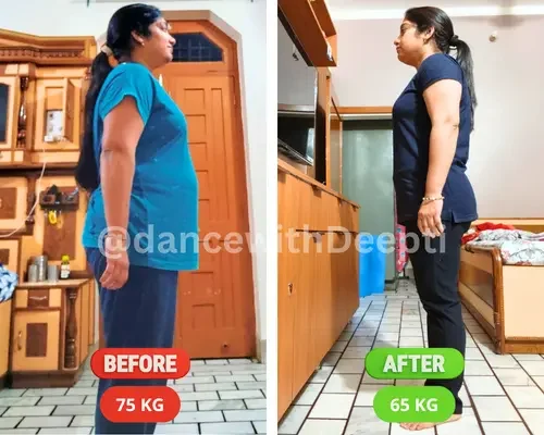 Namita Bansal, 38 &mdash; before and after