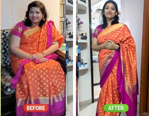 Saiee K &mdash; before and after