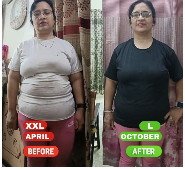 Neeru, 42 &mdash; before and after